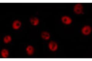 Immunofluorescence (fixed cells) (IF/ICC) image for anti-Checkpoint Kinase 2 (CHEK2) (pThr387) antibody (ABIN6256554)