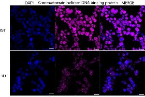 Immunocytochemical staining of HeLa cells using Chromodomain helicase DNA binding protein 3 antibody (ABIN7798069), 1:1,000), Top panel: wild-type (WT), Bottom panal: Chromodomain helicase DNA binding protein 3 shRNA knockdown (KD). (Recombinant CHD3 antibody)