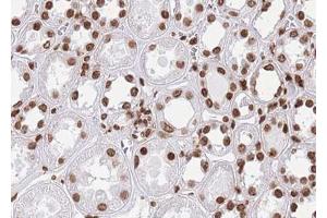 ABIN6268808 at 1/100 staining human kidney tissue sections by IHC-P. (HNRNPL antibody  (N-Term))