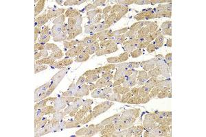 Immunohistochemistry of paraffin-embedded Rat heart using FIS1 antibody at dilution of 1:100 (x400 lens). (Fission 1 antibody)