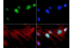 Immunocytochemistry of Rabbit Anti-Histone H3 [Monomethyl Lys18] Antibody. (Histone 3 antibody  (H3K18me))