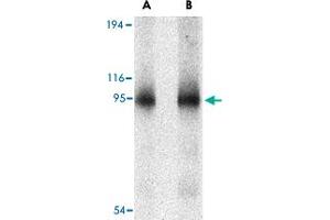 Western blot analysis of CD180 in human spleen tissue lysate with CD180 polyclonal antibody  at (A) 0. (CD180 antibody  (N-Term))