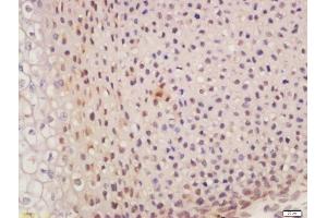 Formalin-fixed and paraffin embedded mouse embryo labeled with Anti-SUFU/Suppressor of Fused Polyclonal Antibody, Unconjugated  at 1:200 followed by conjugation to the secondary antibody and DAB staining (SUFUH antibody  (AA 433-484))