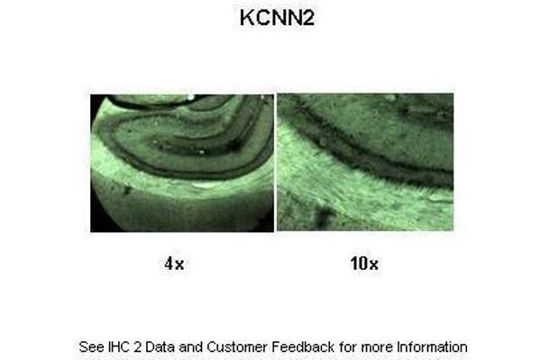 KCNN2 antibody  (C-Term)