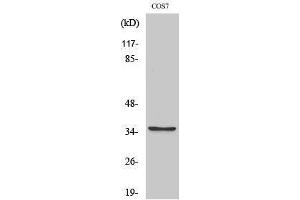 Western Blotting (WB) image for anti-Post-GPI Attachment To Proteins 1 (PGAP1) (Internal Region) antibody (ABIN3174074) (PGAP1 antibody  (Internal Region))