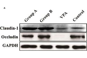 Expression of claudin-1 and occludin in the colonic tissues of different groups. (Claudin 1 antibody  (AA 1-211))