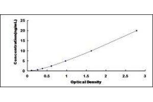 ELISA image for Glycoprotein 2 (Zymogen Granule Membrane) (GP2) ELISA Kit (ABIN434564)