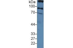 Western Blotting (WB) image for anti-Inter-alpha Globulin Inhibitor H2 Polypeptide (ITIH2) (AA 452-702) antibody (ABIN7436561)