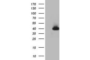 HEK293T cells were transfected with the pCMV6-ENTRY control (Left lane) or pCMV6-ENTRY HIBCH (Right lane) cDNA for 48 hrs and lysed. (HIBCH antibody)