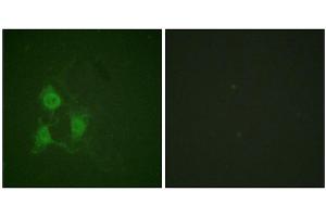 Immunofluorescence staining of methanol-fixed A549 cells using PKA α/β CAT (Phospho-Thr197) Antibody. (PRKACA antibody  (pThr197))