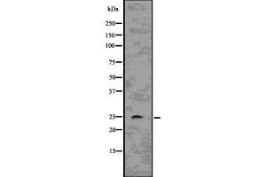 Western blot analysis of RHOQ using COLO205 whole  lysates. (RHOQ antibody  (Internal Region))