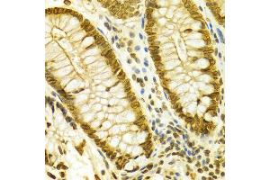 Immunohistochemistry (IHC) image for anti-Lamin B1 (LMNB1) (AA 397-586) antibody (ABIN3015698)