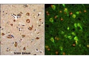 (LEFT)Formalin-fixed and paraffin-embedded human brain tissue reacted with ANXA7 Antibody (Center), which was peroxidase-conjugated to the secondary antibody, followed by DAB staining. (Annexin VII antibody  (AA 329-356))