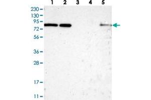 Western blot analysis of Lane 1: RT-4, Lane 2: U-251 MG, Lane 3: Human Plasma, Lane 4: Liver, Lane 5: Tonsil with HCFC2 polyclonal antibody  at 1:250-1:500 dilution. (HCFC2 antibody)