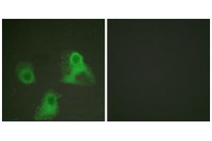 Immunofluorescence analysis of HeLa cells, using ADD1 (phospho-Ser726) antibody (ABIN5975885). (alpha Adducin antibody  (pSer726))