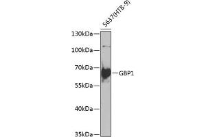Western blot analysis of extracts of 5637(HTB-9) cells, using GBP1 antibody (ABIN6131996, ABIN6140998, ABIN6140999 and ABIN6222645) at 1:1000 dilution. (GBP1 antibody  (AA 383-592))