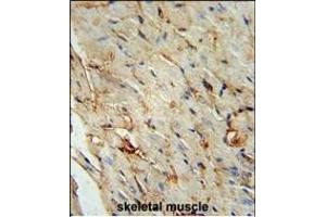 SCAR5 Antibody (C-term) (ABIN653999 and ABIN2843936) immunohistochemistry analysis in formalin fixed and paraffin embedded human skeletal muscle followed by peroxidase conjugation of the secondary antibody and DAB staining. (ZNF592 antibody  (C-Term))