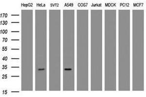 Image no. 2 for anti-Inhibitor of Growth Family, Member 2 (ING2) antibody (ABIN1498886)