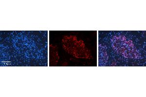 Rabbit Anti-BUD31 Antibody   Formalin Fixed Paraffin Embedded Tissue: Human Testis Tissue Observed Staining: Nucleus in spermatogonia and spermatocytes Primary Antibody Concentration: 1:100 Other Working Concentrations: N/A Secondary Antibody: Donkey anti-Rabbit-Cy3 Secondary Antibody Concentration: 1:200 Magnification: 20X Exposure Time: 0. (BUD31 antibody  (N-Term))