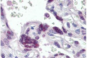 Human Placenta (formalin-fixed, paraffin-embedded) stained with MORF4L1 antibody ABIN462283 followed by biotinylated anti-goat IgG secondary antibody ABIN481715, alkaline phosphatase-streptavidin and chromogen. (MORF4L1 antibody  (AA 2-14))
