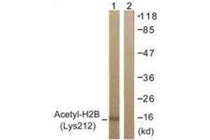 Western blot analysis of extracts from COS7 cells, treated with TSA 400nM 24h, using Histone H2B (Acetyl-Lys12) Antibody. (Histone H2B antibody  (acLys12))