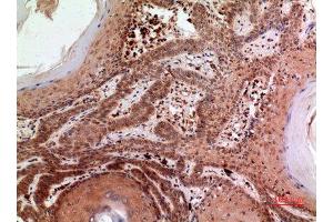 Immunohistochemistry (IHC) image for anti-Replication Factor C (Activator 1) 1, 145kDa (RFC1) (C-Term) antibody (ABIN3187893)