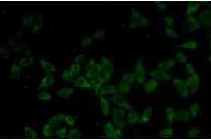 Immunofluorescence analysis of HeLa cells using DNM1 Polyclonal Antibody (Dynamin 1 antibody)