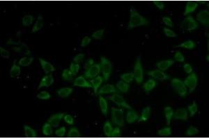 Immunofluorescence analysis of HeLa cells using DNM1 Polyclonal Antibody (Dynamin 1 antibody)