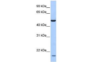 WB Suggested Anti-ZNF764 Antibody Titration:  0. (ZNF764 antibody  (N-Term))