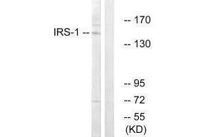Western Blotting (WB) image for anti-Insulin Receptor Substrate 1 (IRS1) (Ser312) antibody (ABIN7180033)