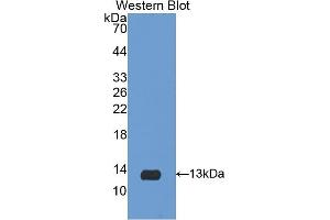 Detection of Recombinant IL8, Porcine using Polyclonal Antibody to Interleukin 8 (IL8) (IL-8 antibody  (AA 26-103))