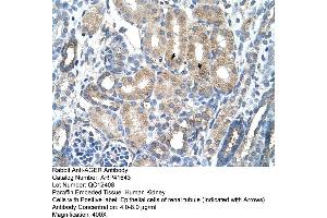 Rabbit Anti-AGER Antibody  Paraffin Embedded Tissue: Human Kidney Cellular Data: Epithelial cells of renal tubule Antibody Concentration: 4. (RAGE antibody  (C-Term))