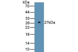 Detection of Recombinant FTH, Human using Monoclonal Antibody to Ferritin, Heavy Polypeptide (FTH) (FTH1 antibody  (AA 1-183))