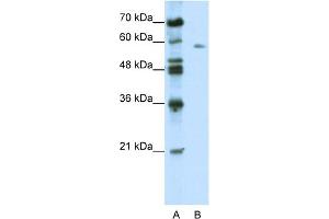 WB Suggested Anti-BTBD14A Antibody Titration:  0. (BTBD14A antibody  (C-Term))
