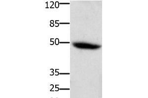 Western Blot analysis of Mouse heart tissue using CD116 Polyclonal Antibody at dilution of 1:400 (CSF2RA antibody)