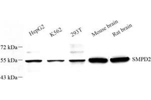 Western blot analysis of nSMase (ABIN7075702) at dilution of 1: 600