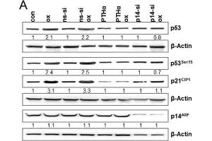 (A) LoVo cells were either exposed to PTHα (30 μM) or transfected with non-specific siRNA (ns-siRNA) or p14ARF specific siRNA. (Goat anti-Mouse IgG Antibody (HRP))