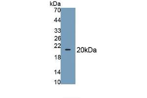 Detection of Recombinant GLUT1, Rat using Polyclonal Antibody to Glucose Transporter 1 (GLUT1)