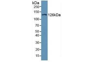 Detection of ITGaD in Human Serum using Polyclonal Antibody to Integrin Alpha D (ITGaD) (ITGAD antibody  (AA 879-1099))