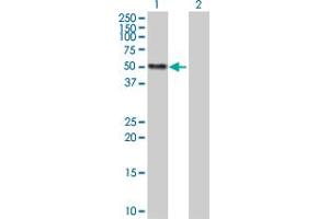 Western Blot analysis of CALR expression in transfected 293T cell line by CALR MaxPab polyclonal antibody. (Calreticulin antibody  (AA 1-417))