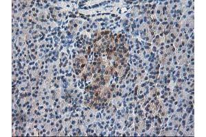 Immunohistochemical staining of paraffin-embedded Human pancreas tissue using anti-RBP1 mouse monoclonal antibody. (RBP1 antibody)
