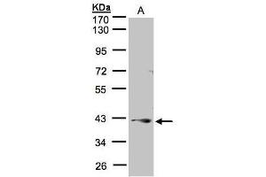 WB Image Sample(30 μg of whole cell lysate) A:A431, 10% SDS PAGE antibody diluted at 1:1000 (PPP2R4 antibody  (Center))