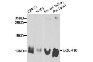 Western blot analysis of extracts of various cell lines, using UQCR10 antibody. (UQCR10 antibody  (AA 1-63))