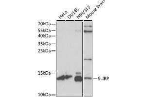 Western blot analysis of extracts of various cell lines, using SLIRP antibody. (SLIRP antibody)