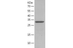Western Blotting (WB) image for CD81 (CD81) (AA 110-150) protein (His-IF2DI Tag) (ABIN7122215) (CD81 Protein (CD81) (AA 110-150) (His-IF2DI Tag))