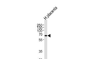 Western blot analysis of lysate from human placenta tissue lysate, using P19 Antibody (N-term) (ABIN657681 and ABIN2846673). (MMP19 antibody  (N-Term))