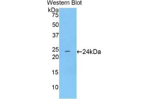 Detection of Recombinant TNNI1, Rat using Polyclonal Antibody to Troponin I Type 1, Slow Skeletal (TNNI1) (TNNI1 antibody  (AA 1-187))