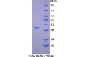SDS-PAGE analysis of Human ENPP1 Protein. (ENPP1 Protein)