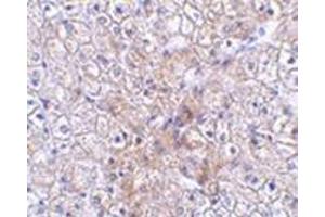 Immunohistochemistry of TRAF2 in human liver tissue with this product at 2.