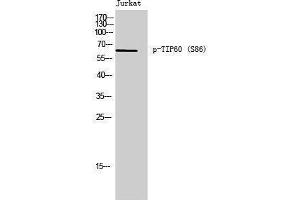 Western Blotting (WB) image for anti-K(lysine) Acetyltransferase 5 (KAT5) (pSer86) antibody (ABIN3182239) (KAT5 antibody  (pSer86))